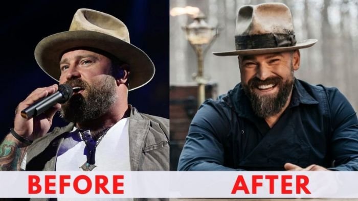 Zac Brown Before and After Weight Loss