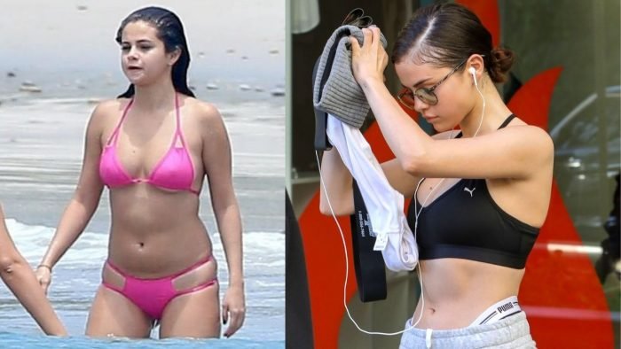 Selena Gomez Before after