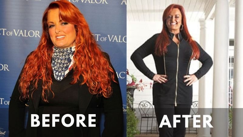 Wyonna Judd Before and After