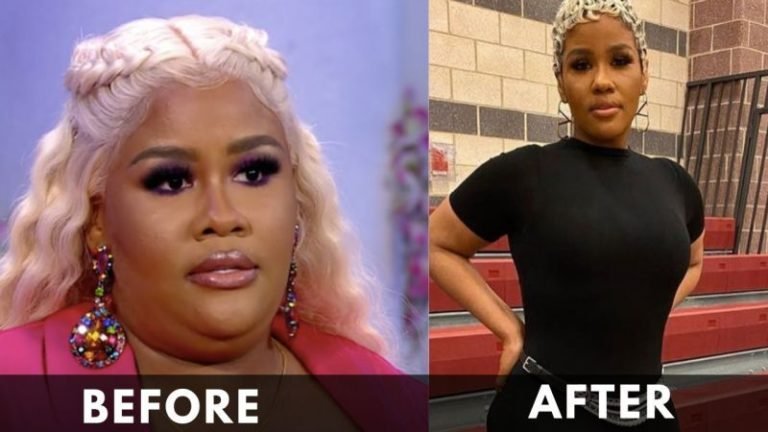 Akbar V Weight Loss [2024]: Before and After Journey