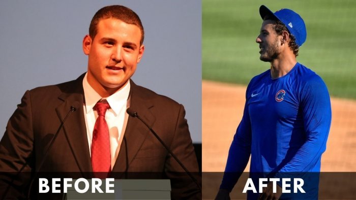 Anthony Rizzo before after weight loss