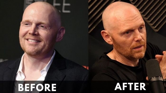 Bill Burr Before After weight loss