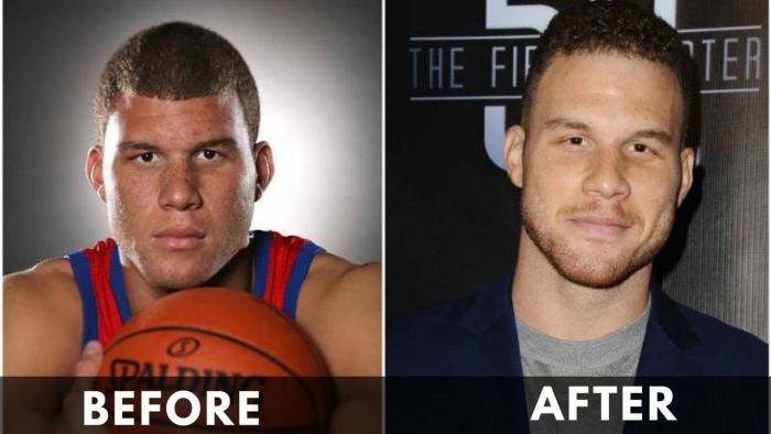 Blake Griffin before and after weight loss