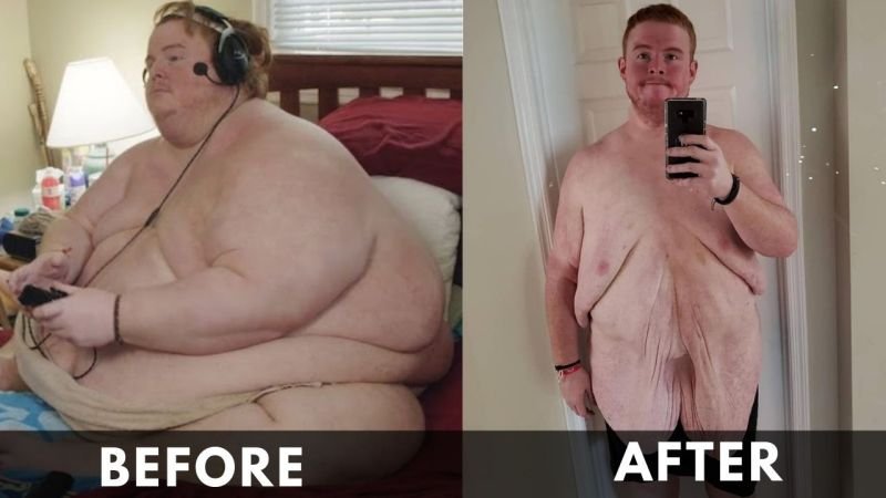 Casey King Before and After