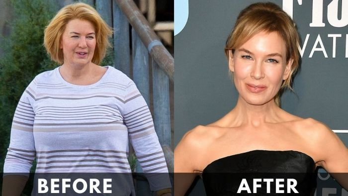 Renee Zellweger before after weight loss