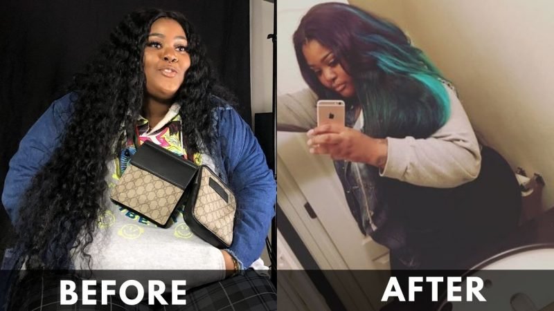 Tokyo Vanity before and after Weight Loss 2