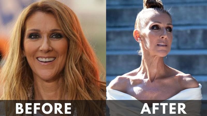 Celine Dion before after weight loss