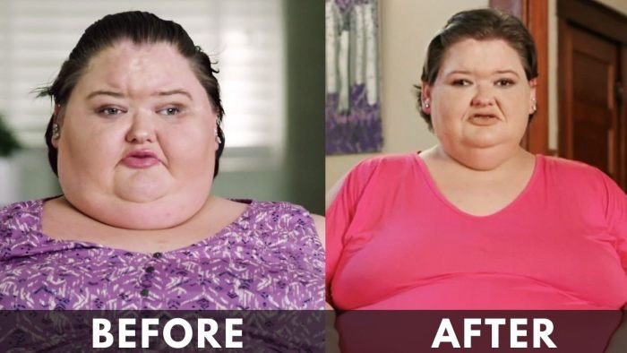 Amy Slaton before after weight loss