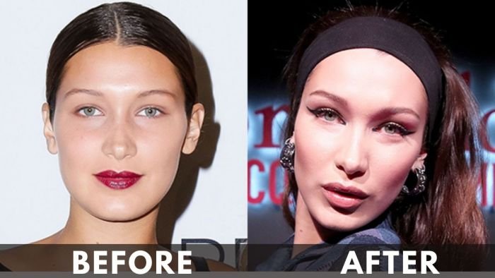 Bella Hadid before after weight loss 2