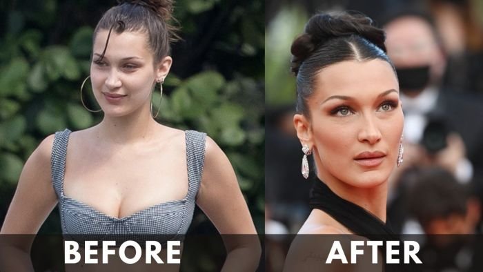 Bella Hadid before after weight loss