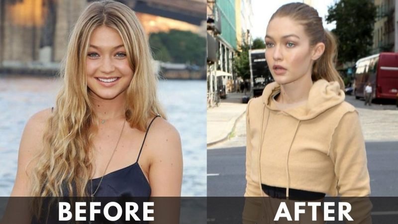 Gigi Hadid before after weight loss