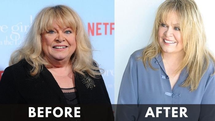 Sally Struthers before after weight loss