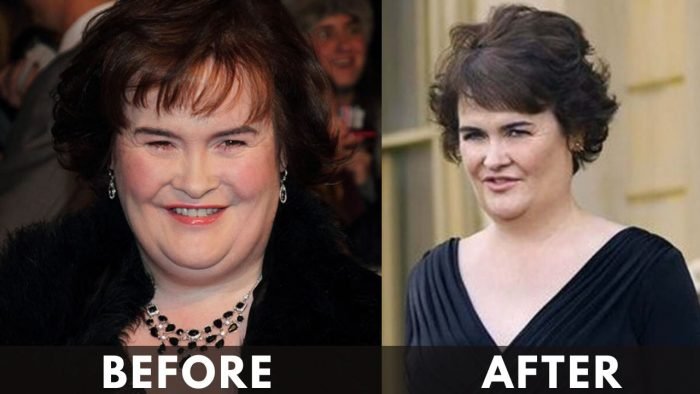 Susan Boyle before after weight loss