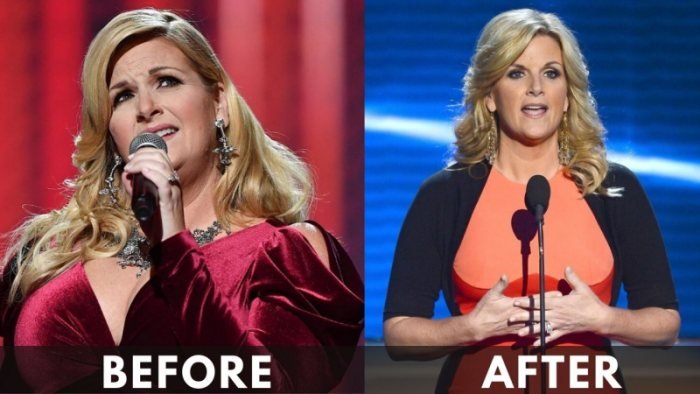 Trisha Yearwood before after weight loss