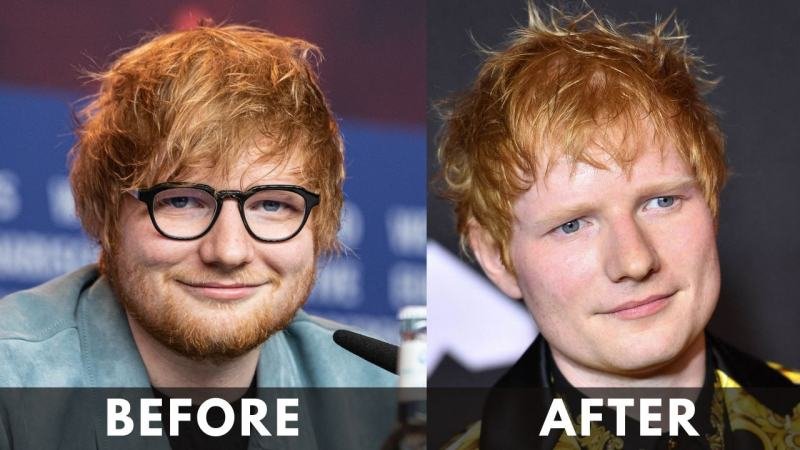 Ed Sheeran before after weight loss