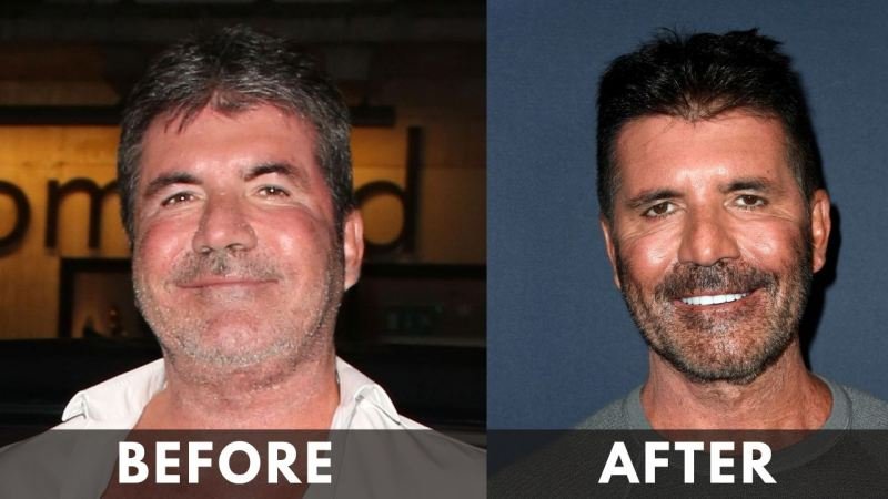 Simon Cowell before after weight loss