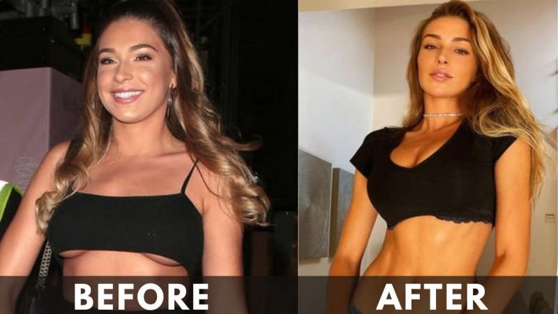 Zara Mcdermott before and after