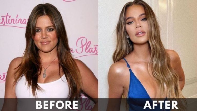Khloe Kardashian Before After Weight Loss 768x432 