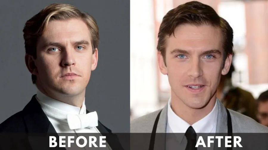 Dan Stevens before after weight loss