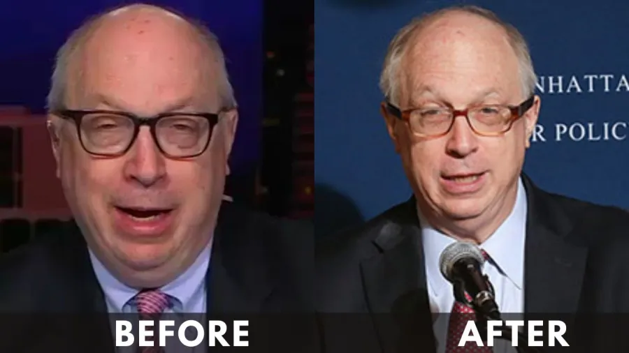 Doug Schoen before after weight loss