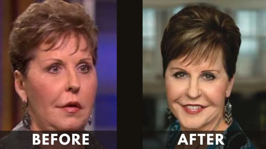 Joyce Meyer before and after weight loss