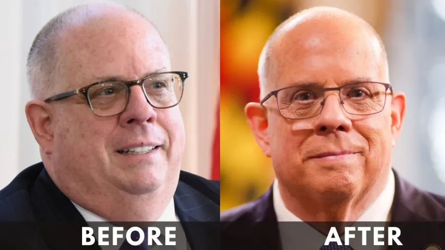 Larry Hogan before after weight loss