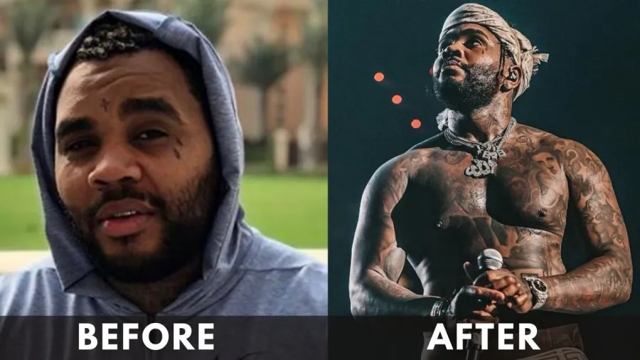 Kevin Gates before after weight loss