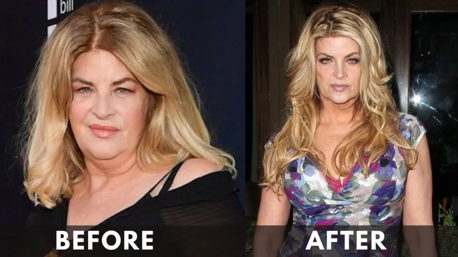 Kirstie Alley before after weight loss