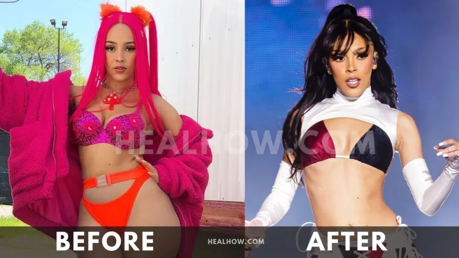 Doja Cat before after weight loss