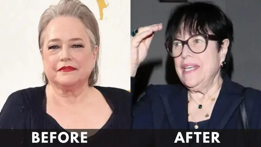 Kathy Bates before after weight loss
