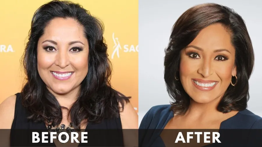 Lynette Romero before after weight loss