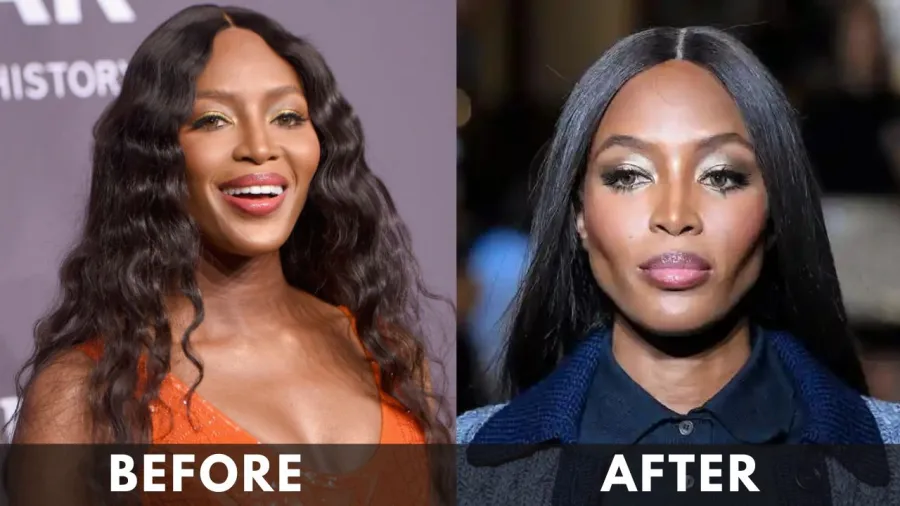 Naomi Campbell before after weight loss