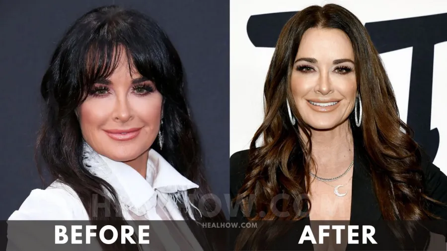 Kyle Richards before after weight loss
