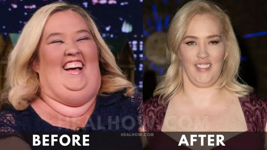Mama June before after weight loss