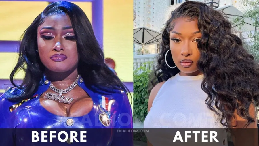 Megan Thee Stallion before after weight loss