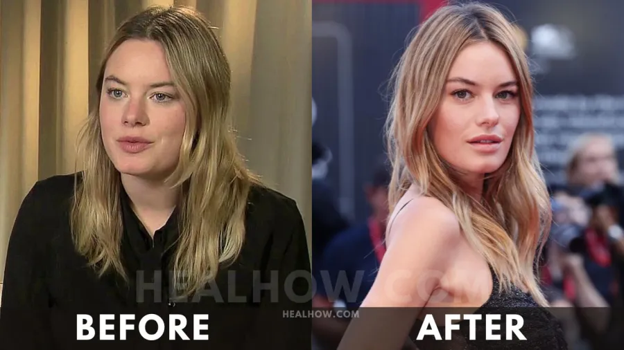 Camille Rowe before after weight loss