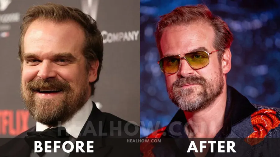 David Harbour before after weight loss