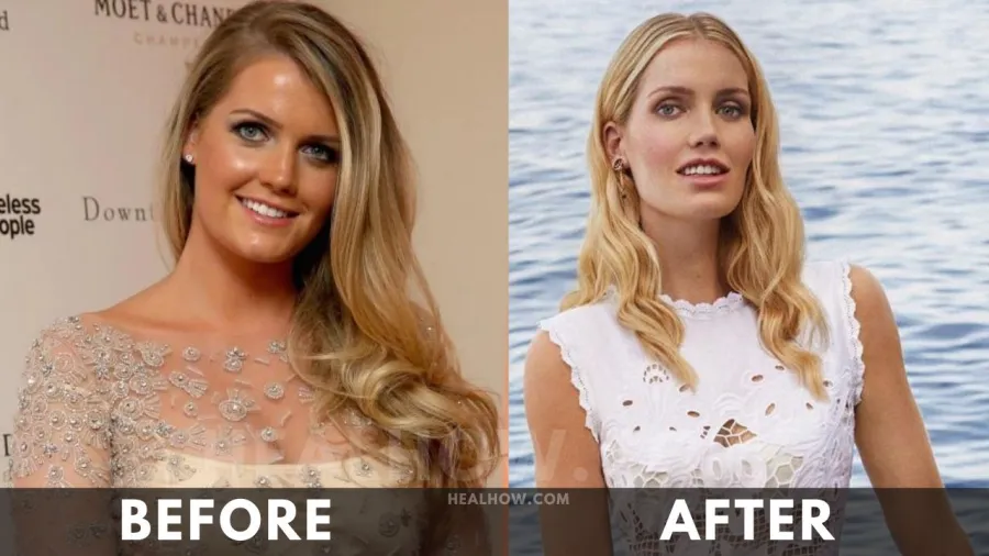 Kitty Spencer before after weight loss