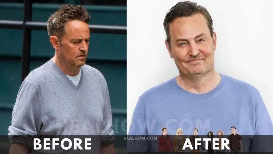 Matthew Perry before after weight loss