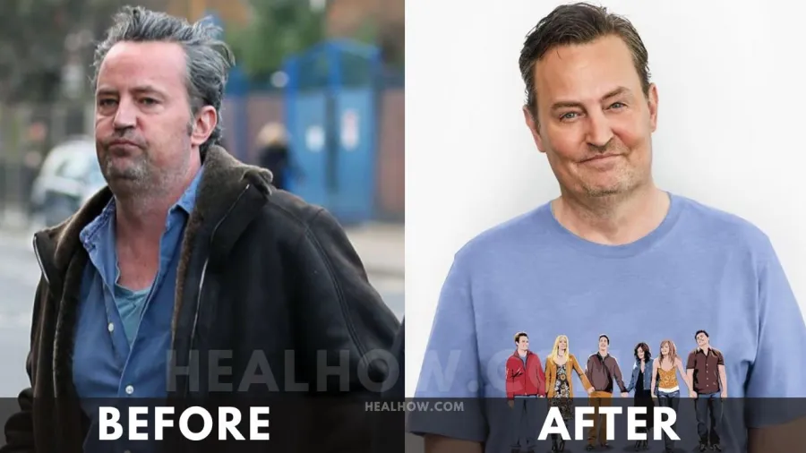 Matthew Perry before after weight loss