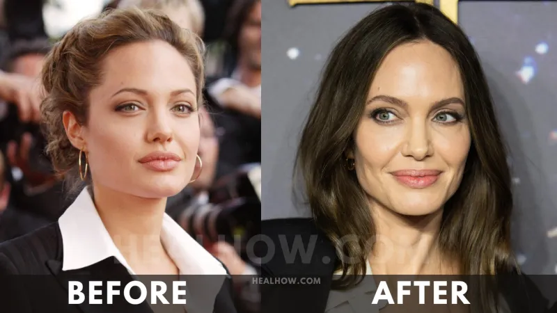 Angelina Jolie before after weight loss