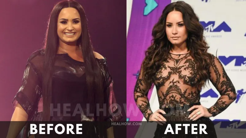 Demi Lovato before after weight loss
