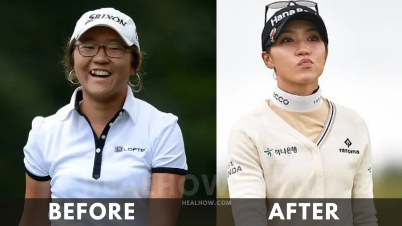 Lydia Ko Before After Weight Loss