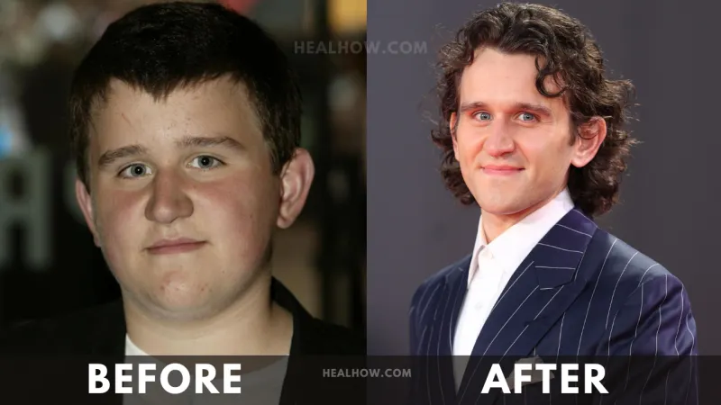 Harry Melling before after weight loss