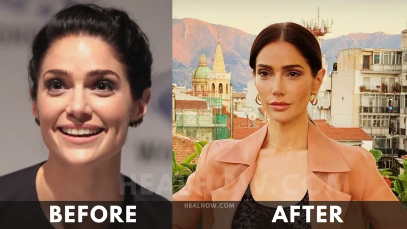 Janet Montgomery before after weight loss