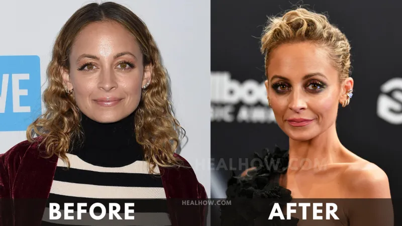 Nicole Richie before after weight loss