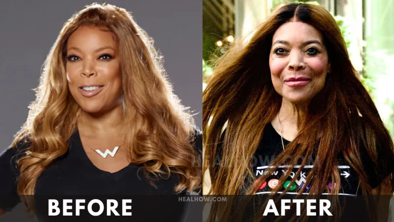 Wendy Williams before after weight loss