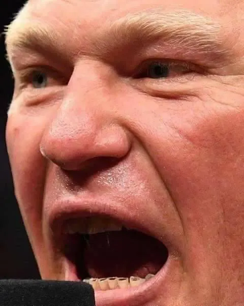Brock Lesnar Teeth