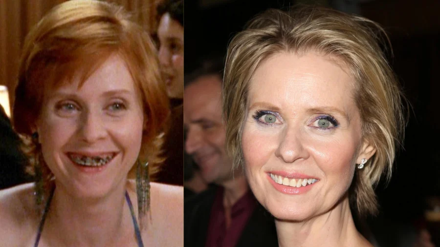 Cynthia Nixon Teeth before after