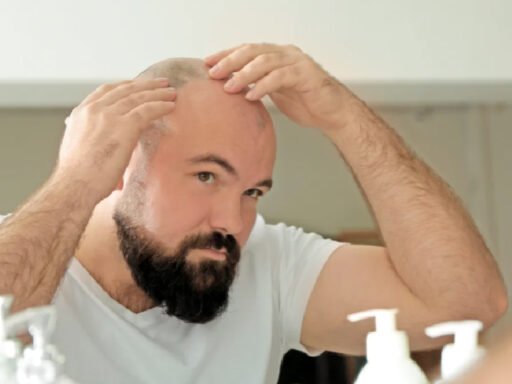Choosing a Moisturizer for Your Bald Head
